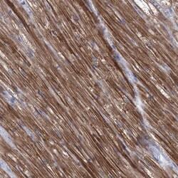 SBK2 Antibody, Novus Biologicals:Antibodies:Primary Antibodies
